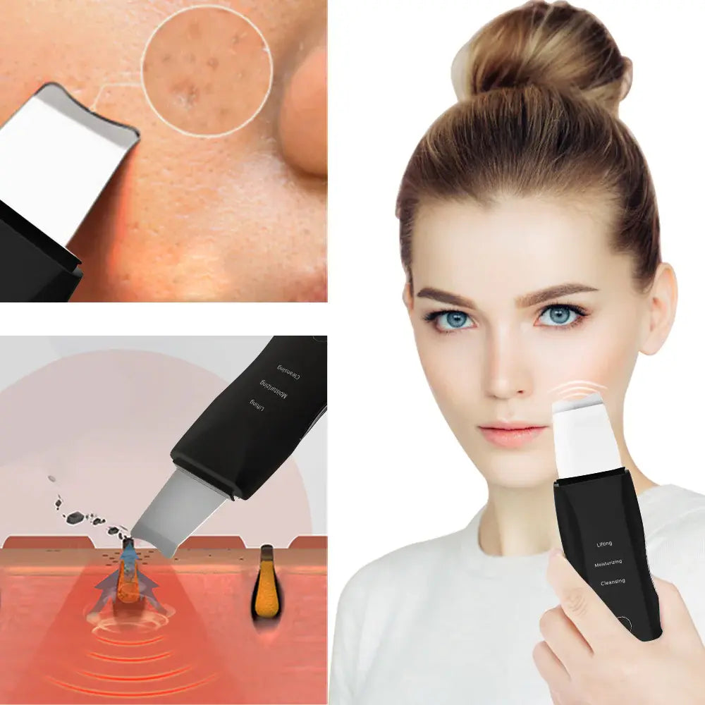 Ultrasonic Skin Scrubber – 5-in-1 Multifunctional Deep Face Cleansing Elite Mall pk